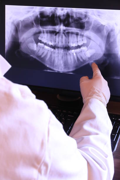 Best Emergency Tooth Extraction in Hewitt, TX