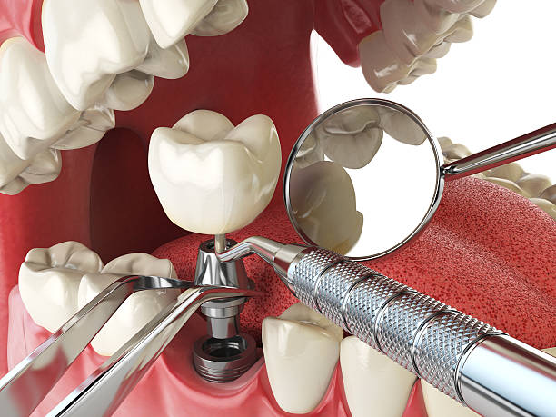 Best After-Hours Emergency Dentist in Hewitt, TX